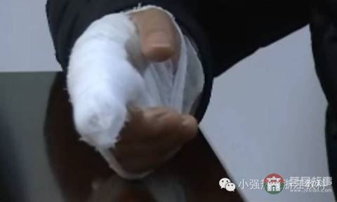 小伙去足浴店洗腳 竟把手指給洗沒了